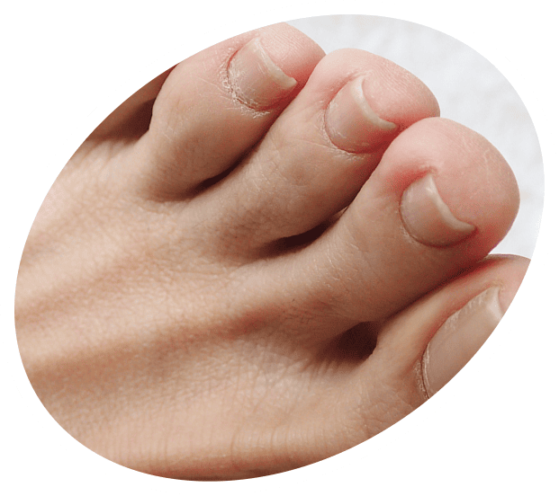 巻いていないけど痛い